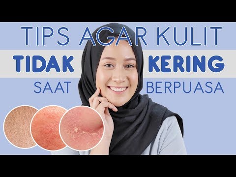 download lagu mp3 mp4 Tips Mengatasi Kulit Kering Saat Puasa, download lagu Tips Mengatasi Kulit Kering Saat Puasa gratis, unduh video klip Tips Mengatasi Kulit Kering Saat Puasa