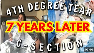 4TH DEGREE TEAR & RECTAL TEAR RECOVERY UPDATE | 7 years later..