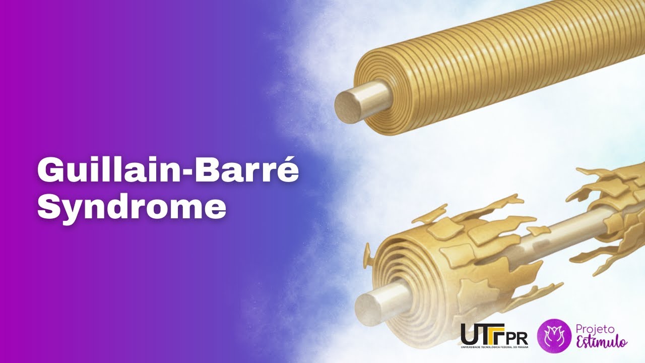 🔴 Guillain-Barré Syndrome: What You Need to Know