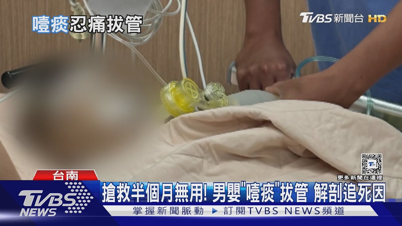 半月搶救無奇蹟發生 4月大男嬰「噎痰」瀕腦死家長忍痛拔管