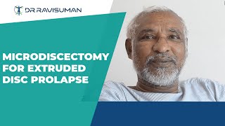 Microdiscectomy for extruded disc prolapse | Dr. Ravi Suman Reddy