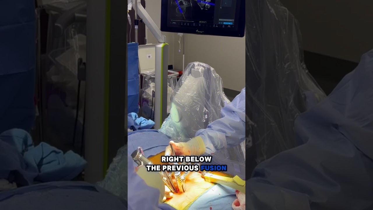 #AI Surgery Follow-Up