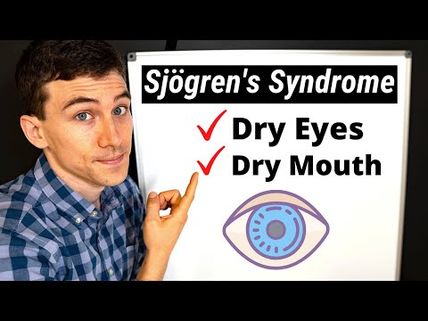 What is Sjögren's Syndrome? Eye Doctor Explains