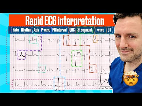 Rapid, structured ECG interpretation: A visual guide FOR REVISION!! #electrocardiogram