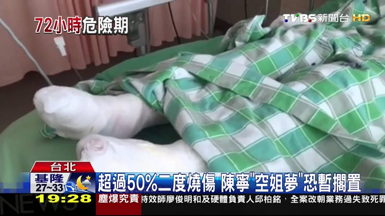 燒燙傷3天關鍵期! 重傷201人與「生命拔河」