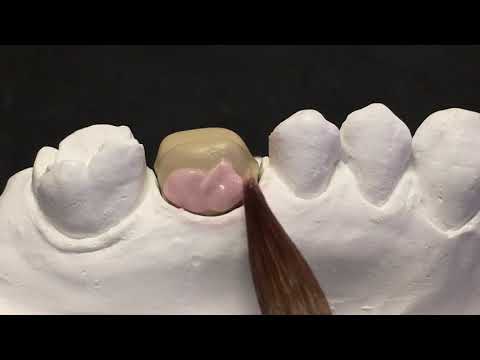 EX-3 SPEED ENAMEL: una sola cottura bi-strato