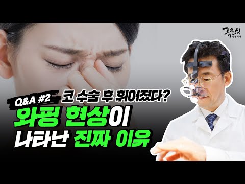 자가 연골 코 성형 후 코가 휘는 와핑 현상!! 그 두 번째 이야기 #2