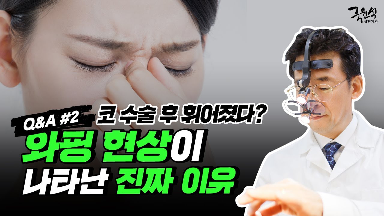 자가 연골 코 성형 후 코가 휘는 와핑 현상!! 그 두 번째 이야기 #2 썸네일