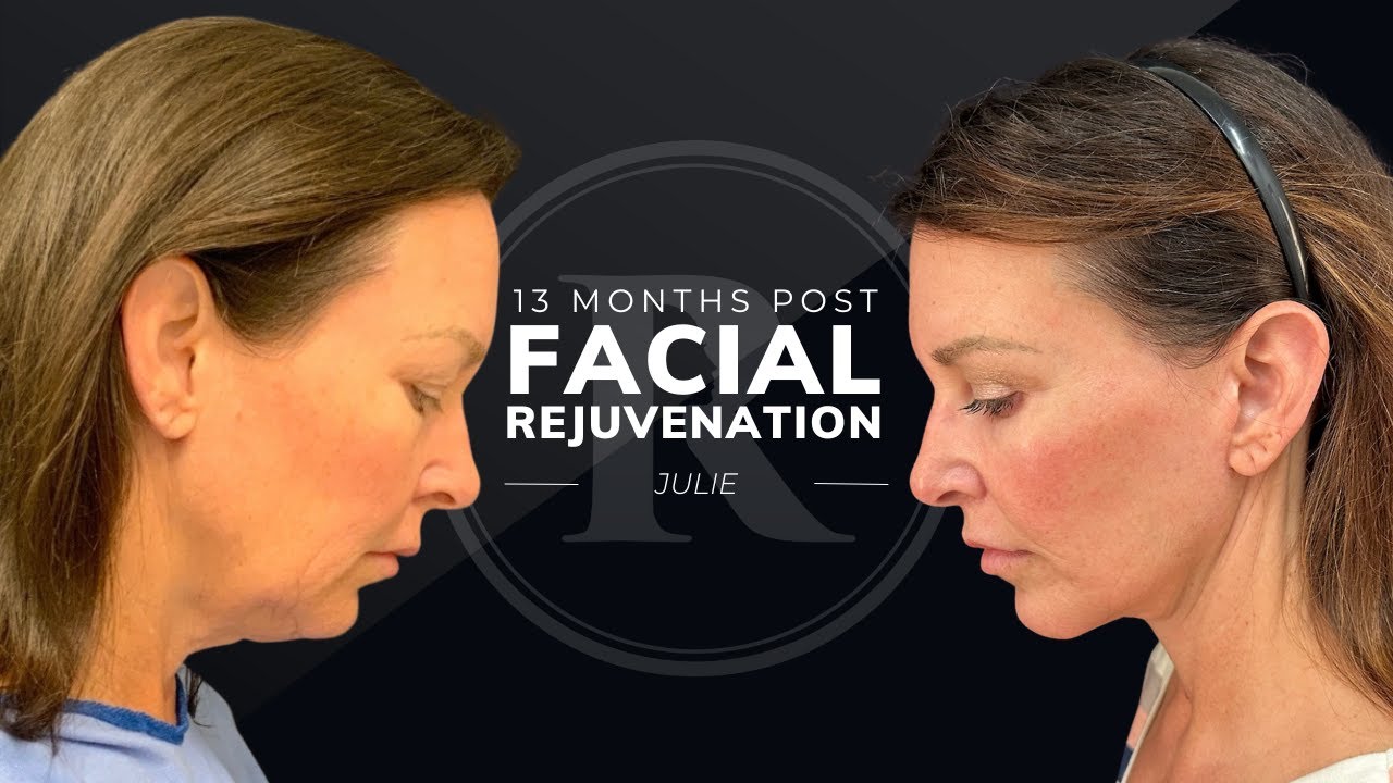 Robb Facial Plastic Surgery