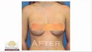 Ponte Vedra Plastic Surgery