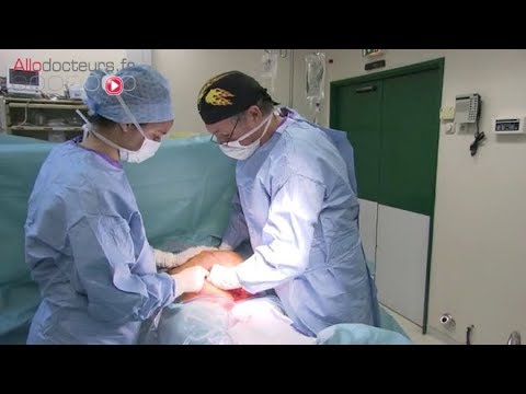 Césarienne : l'accouchement chirurgical - Le Magazine de la santé