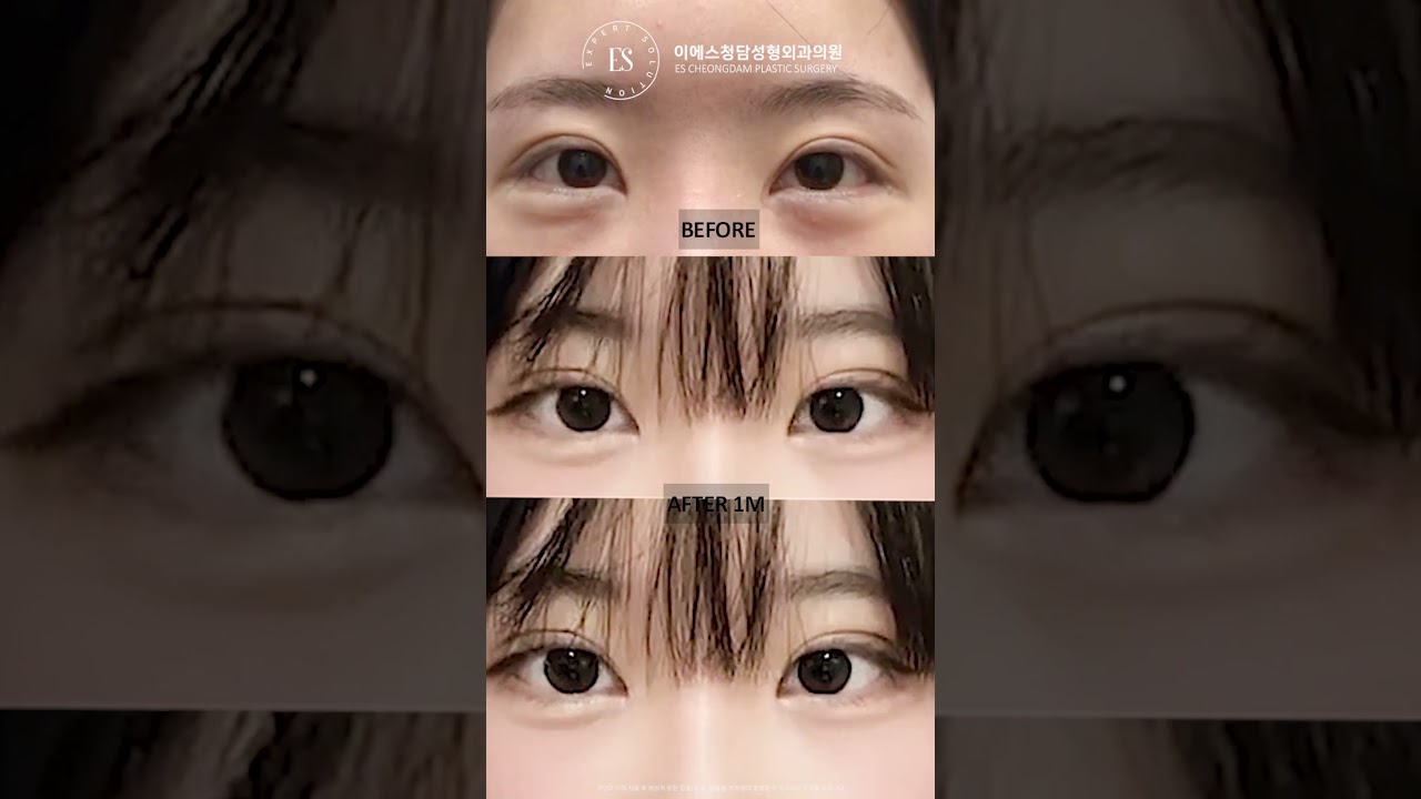 이에스 유튜브