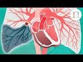 Pulmonary Embolism The Route To Recovery