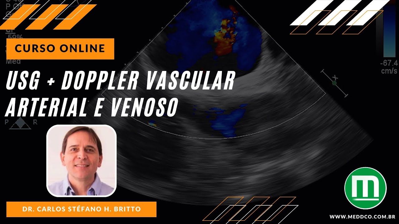 Curso de USG Ultrassonografia Doppler Vascular