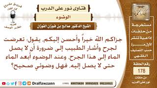 كيف تكون صفة الوضوء وعلى الأعضاء جروح يخشى عليها الماء؟ الشيخ صالح الفوزان image