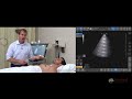 Point Of Care Lung Ultrasound POCUS