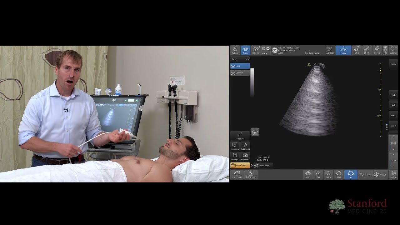 Point of Care Lung Ultrasound (POCUS)