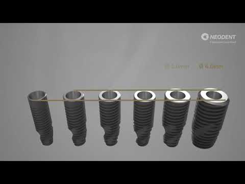 Neodent® NeoArch® Immediate Fixed Full-Arch Solution