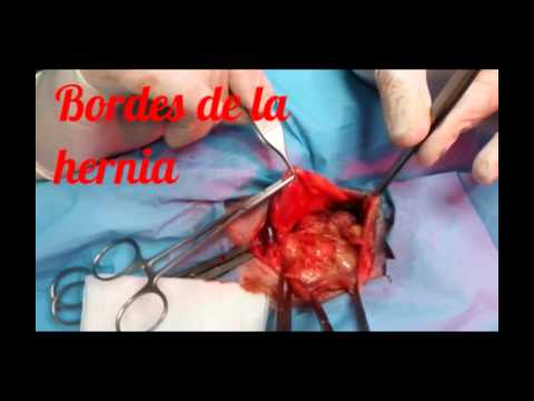Arrossamento della pelle sopra il giunto Quale migliore cuscino da malattia degenerativa del disco della colonna cervicale