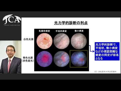 栄養学科 講演2「光で診断する ー泌尿器科領域ー」三宅 秀明（浜松医科大学 泌尿器科学講座 教授）
