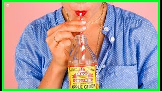 How Much Apple Cider Vinegar A Day Is Safe To Use? | Best Home Remedies