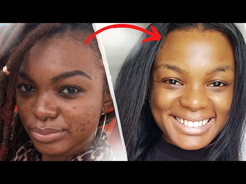 5 SAVONS/NETTOYANTS VISAGE POUR UN TEINT SANS IMPERFECTIONS: LE SECRET DE MA PEAU💖 | Parys Batonda