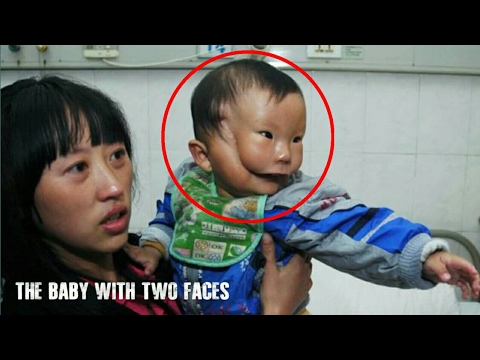 Upang mawala ang timbang ay hindi dapat kainin pagkatapos ng ehersisyo Ano ang mga pamamaraan para sa mabilis na pagbaba ng timbang