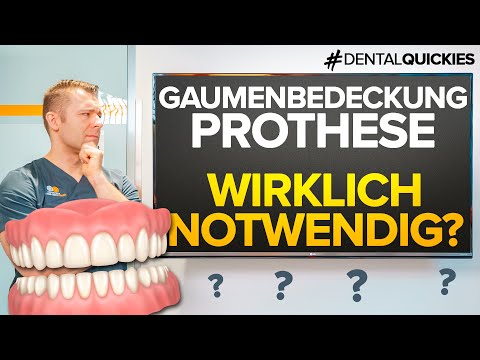 Gaumenfreie Prothese ohne Implantate - Das ist wirklich möglich! Vollständige Dentition auf Prothesen