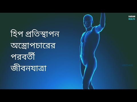 হিপ প্রতিস্থাপন অস্ত্রোপচারের পরবর্তী জীবন