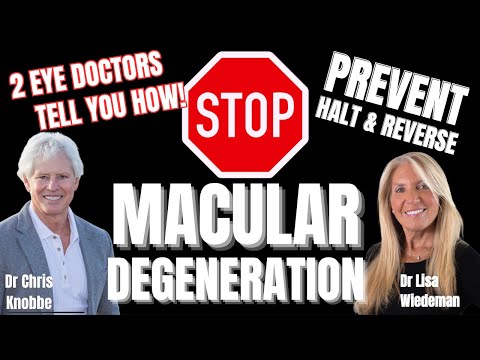 DO THIS NOW!!! Save your Vision! Watch this & Learn Exactly HOW -  Let's STOP Macular Degeneration!!