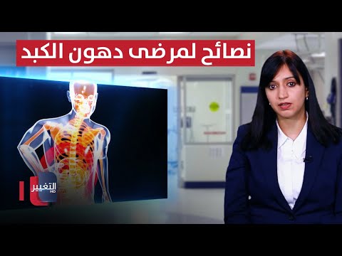 شاهد بالفيديو.. نصائح مهمة لمرضى دهون الكبد أثناء صيام رمضان | توازن