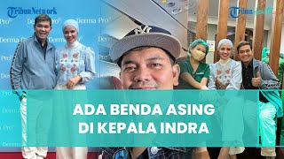 Sembuh dari Penyakit Mematikan, Kondisi Terkini Indra Bekti Membaik, Akui Ada Benda Asing di Kepala