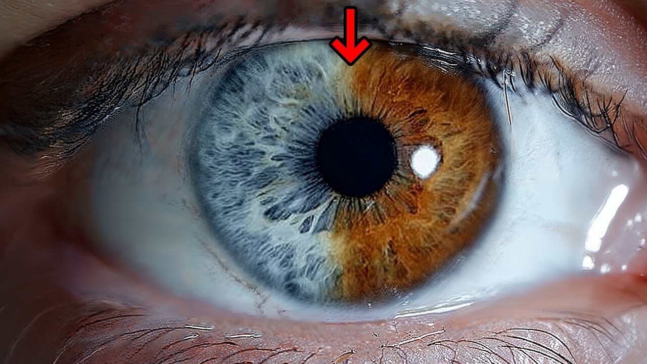 Eye Condition You Might Never See + 20 Rare Body Features