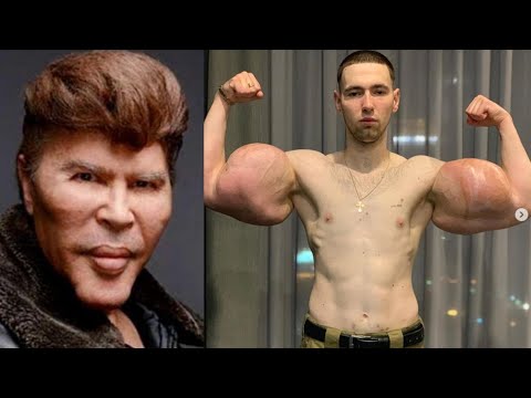 Bad Plastic Surgery