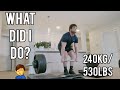 Deadlift Injury *WARNING GRAPHIC*