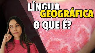 Lngua geogrfica - o que ? Tem tratamento?
