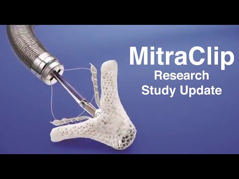 MitraClip Update:  The COAPT Trial Results Are Encouraging!