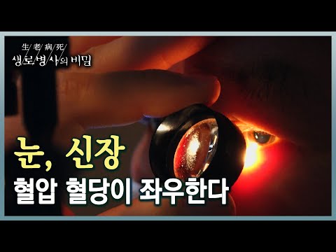 , title : '혈압, 혈당 관리 빨간불... 소혈관 질환이 당신의 눈과 신장을 위협한다 (KBS 20230308 방송)'