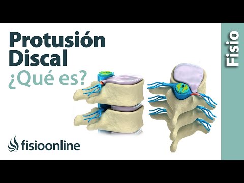 Protrusión discal - ¿Qué es?