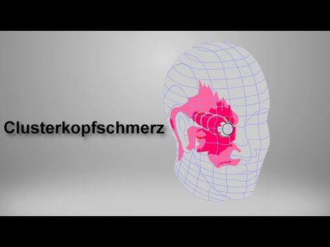 myREGIO.TV: Clusterkopfschmerz