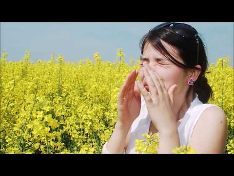 Dr. Brooks Trotter - Allergies, Immunology Testing - Grapevine, Keller, Colleyville, Southlake mp3 yukle - mp3.DINAMIK.az Dr. Brooks Trotter - Allergies, Immunology Testing - Grapevine, Keller, Colleyville, Southlake mp3 yukle - mp3.DINAMIK.az