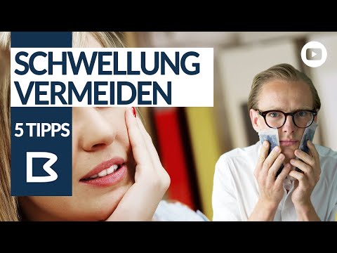 ZAHN gezogen? TOPP 5 Tipps gegen Schwellung!