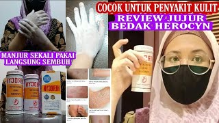 Download lagu HONEST REVIEW OF HEROCYN POWDER FOR ITCHY SKIN DISEASES' || Ica Ica vlog #herocyn #unboxing Herocyn mp3