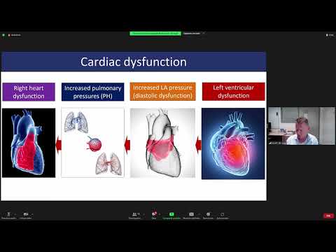 The management of an infant with septic shock,