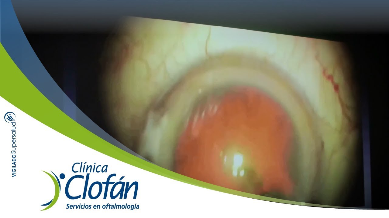 Germán Giraldo García-9