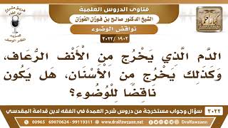 صورة [1902 -3022] هل الدم الذي يخرج من الأنف ومن الأسنان ينقض الوضوء؟ - الشيخ صالح الفوزان