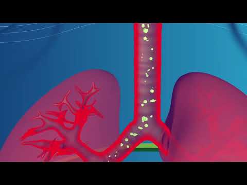 How Asthma Affects Breathing