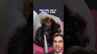 UNBELIEVABLE Cavity Filling - Explained