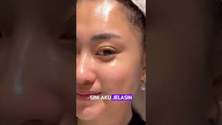Download lagu Why does your skin glow after a skin booster? #dokdan #skinbooster #salmondna #botox #filler #face mp3 Download lagu Why does your skin glow after a skin booster? #dokdan #skinbooster #salmondna #botox #filler #face mp3