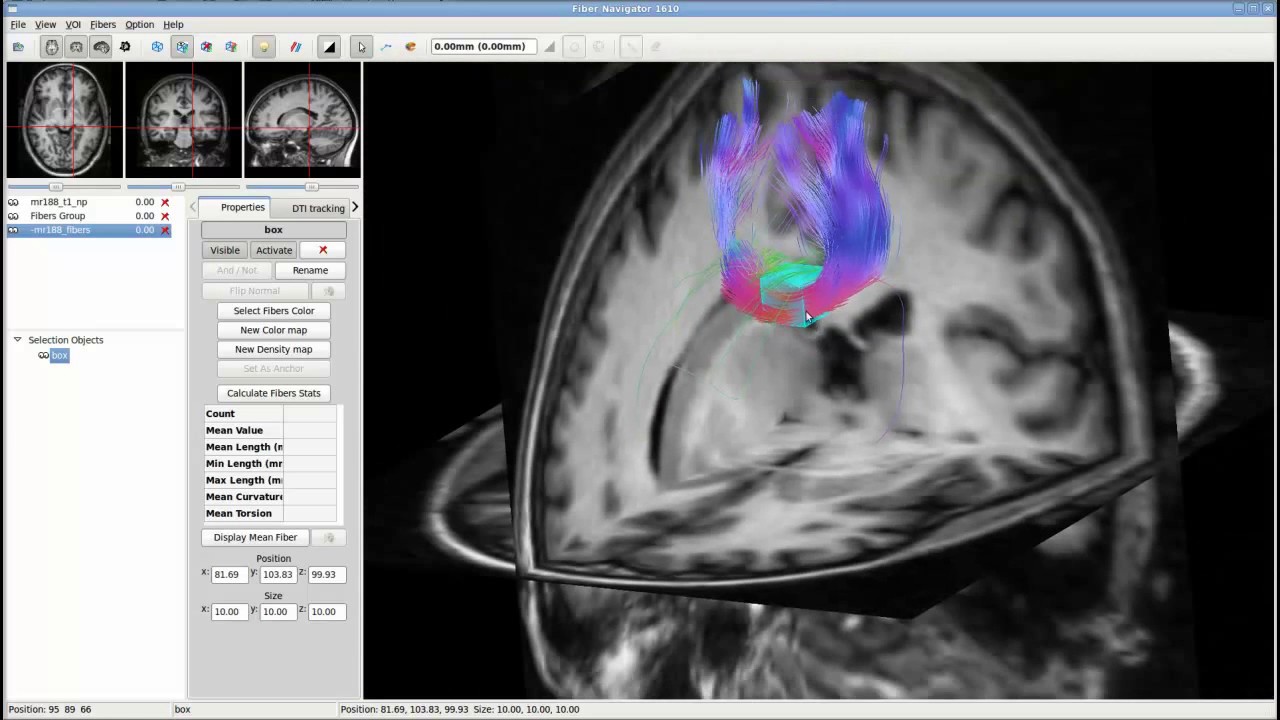 Fibernavigator tutorial